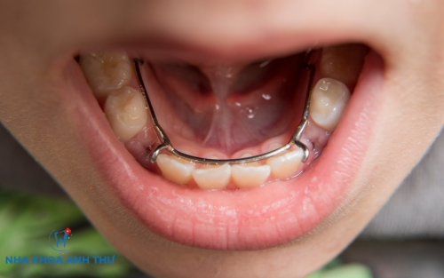 HÀM GIỮ KHOẢNG LÀ GÌ? TÁC DỤNG, CÁC LOẠI HÀM GIỮ KHOẢNG VÀ KHI NÀO CẦN SỬ DỤNG?