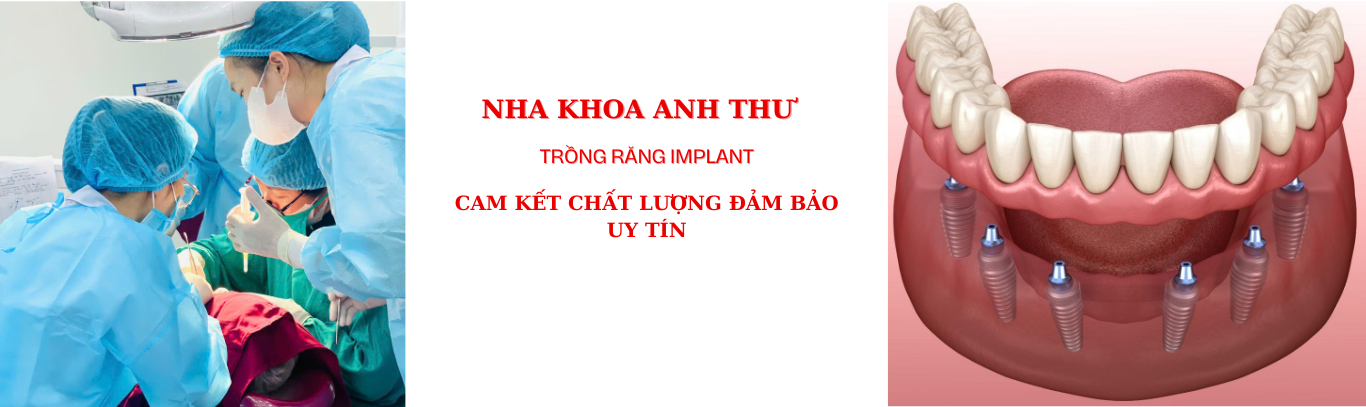 Nha khoa Anh Thư 