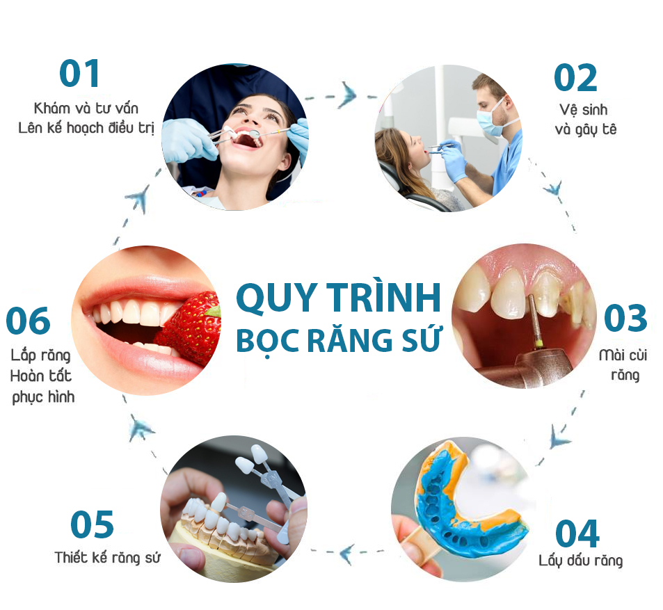 Quy trình phục hình răng sứ