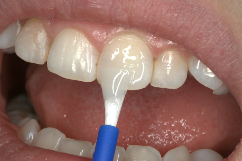 nha-kha-anh-thu-Vecni-Flour-2