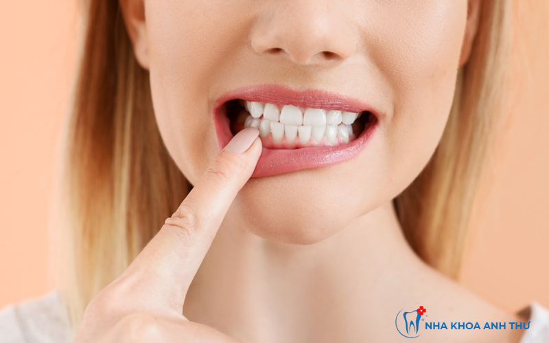 nha-khoa-anh-thu-12-benh-rang-mieng-4
