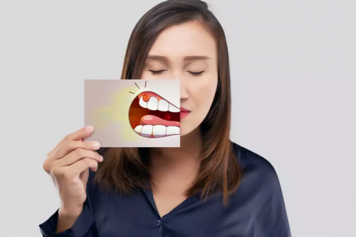 ÁP XE RĂNG: DẤU HIỆU, NGUYÊN NHÂN VÀ BIẾN CHỨNG THƯỜNG GẶP