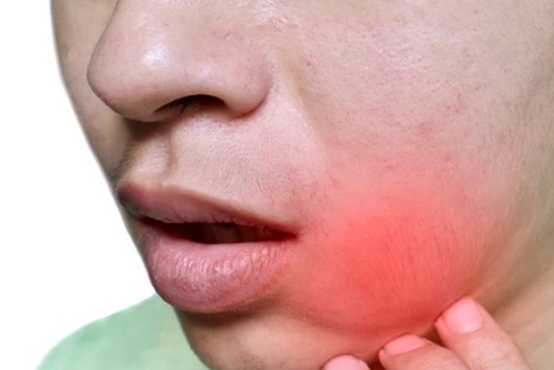 nha-khoa-anh-thu-ap-xe-rang-8