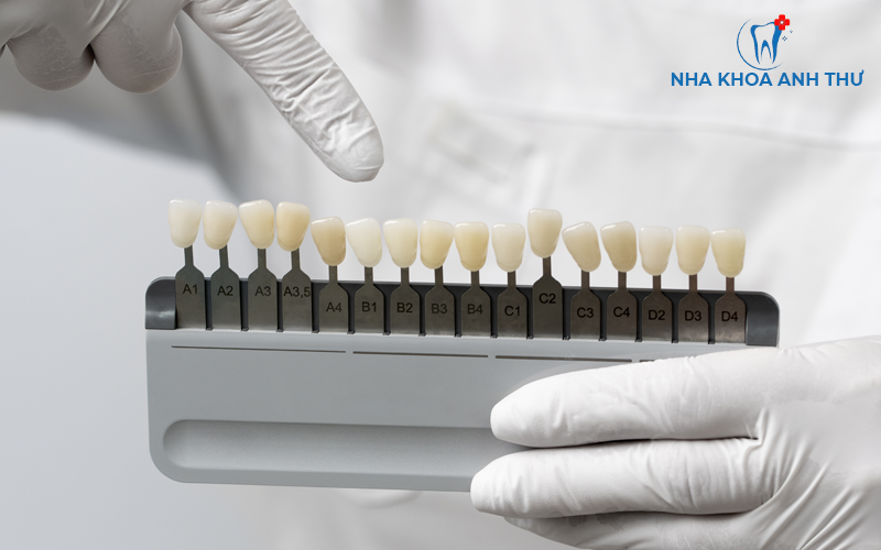 nha-khoa-anh-thu-bang-mau-rang-su-3