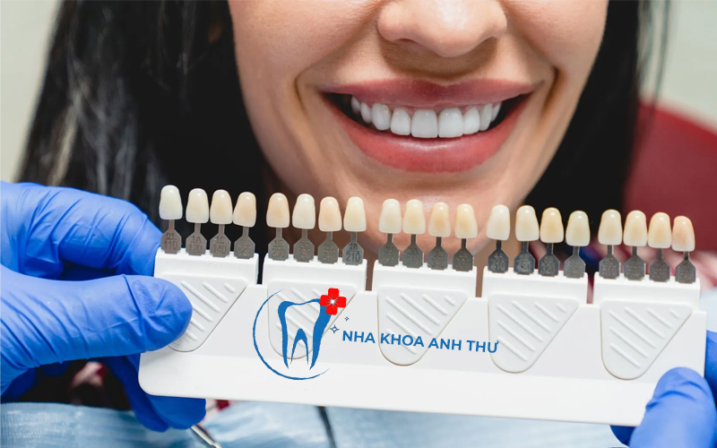 nha-khoa-anh-thu-bang-mau-rang-su-4