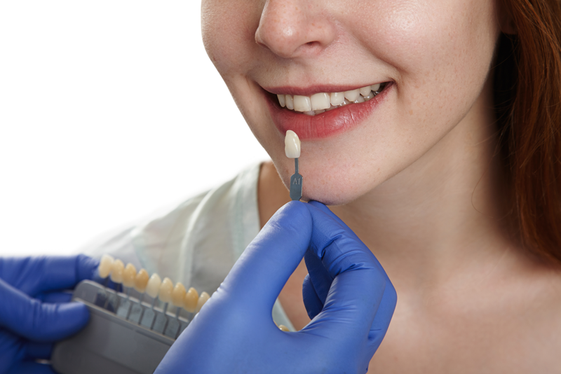 nha-khoa-anh-thu-boc-rang-su-2