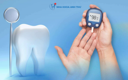 NHỮNG LƯU Ý KHI CHĂM SÓC RĂNG MIỆNG CHO NGƯỜI BỆNH ĐÁI THÁO ĐƯỜNG