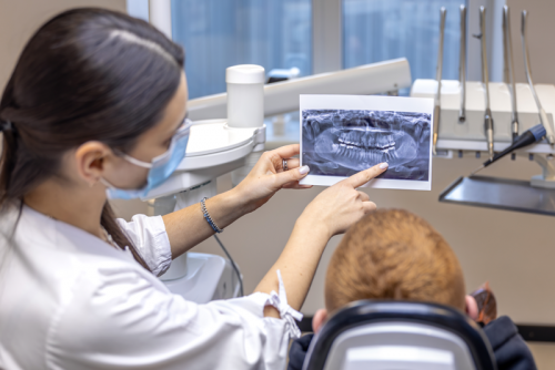 NHỔ RĂNG KHÔN TẠI NHA KHOA ANH THƯ