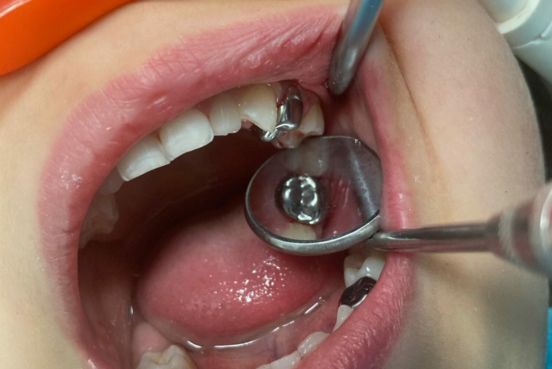 nha-khoa-anh-thu-chup-thep-co-san-5