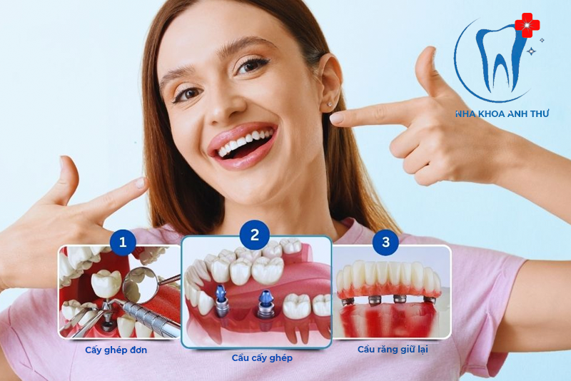 nha-khoa-anh-thu-dich-vu-5