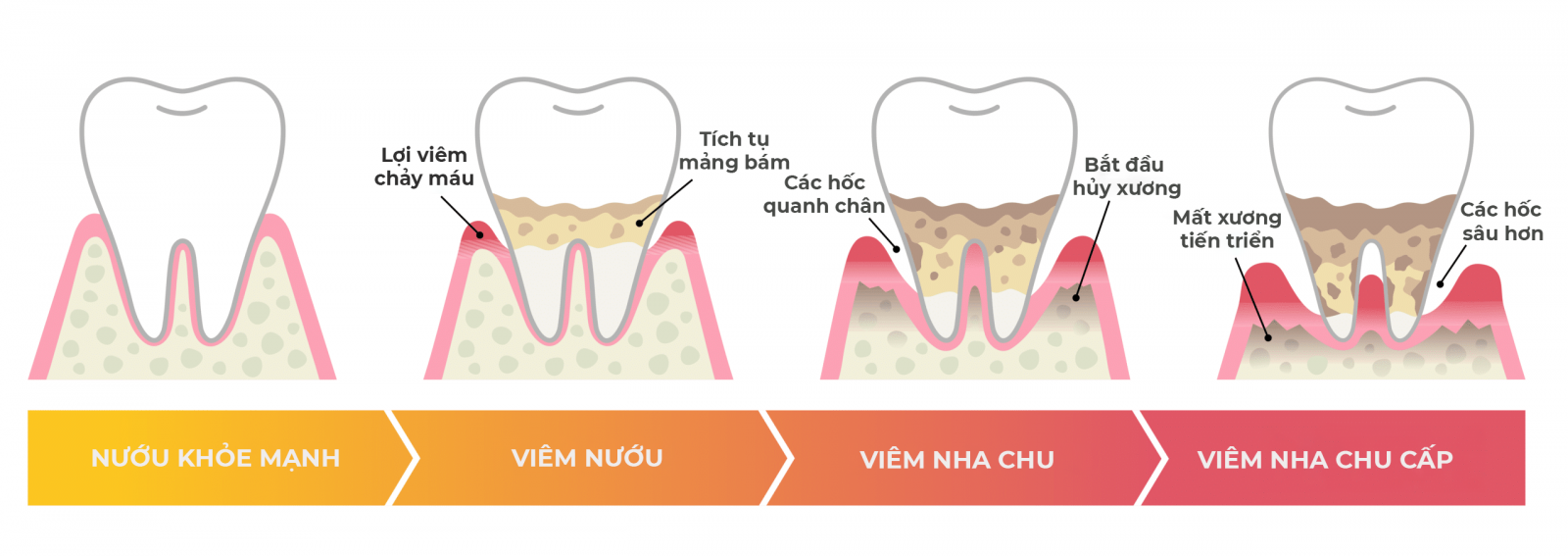 nha khoa anh thư điều trị viêm lợi 08