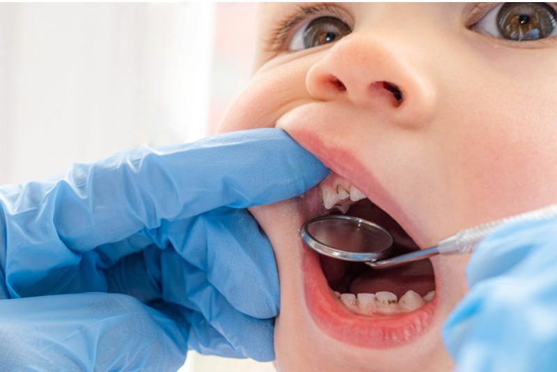 nha-khoa-anh-thu-hinh-anh-sau-rang-tre-em-6