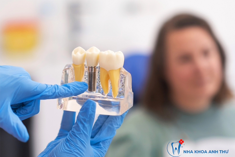 nha-khoa-anh-thu-implant-thuy-si-2