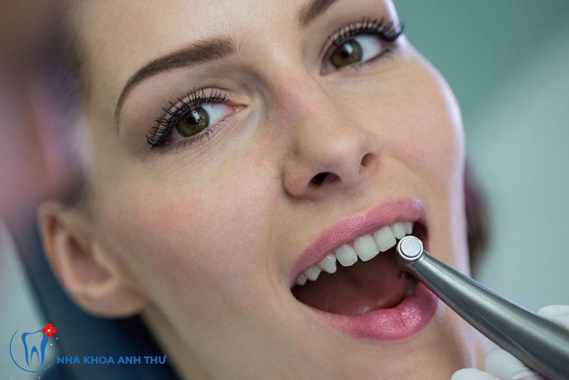 nha-khoa-anh-thu-implant-thuy-si-3