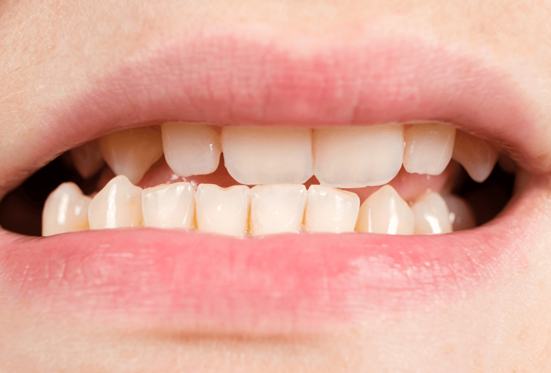 nha-khoa-anh-thu-khop-can-doi-dinh-2