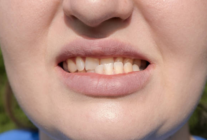 nha-khoa-anh-thu-khop-can-doi-dinh-5