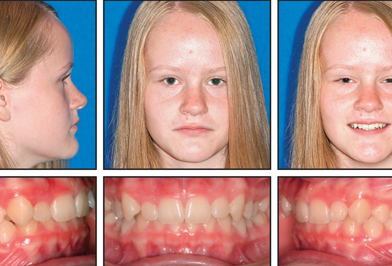 nha-khoa-anh-thu-khop-can-doi-dinh-6