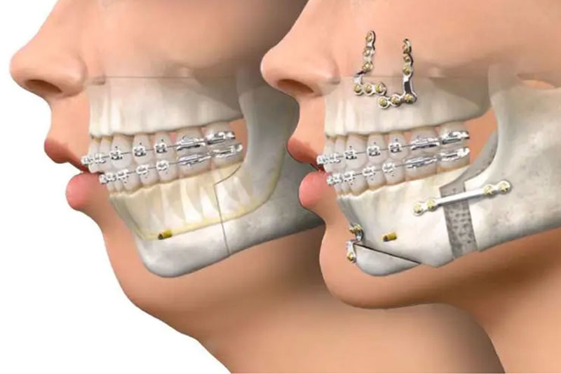 nha-khoa-anh-thu-khop-can-nguoc-6