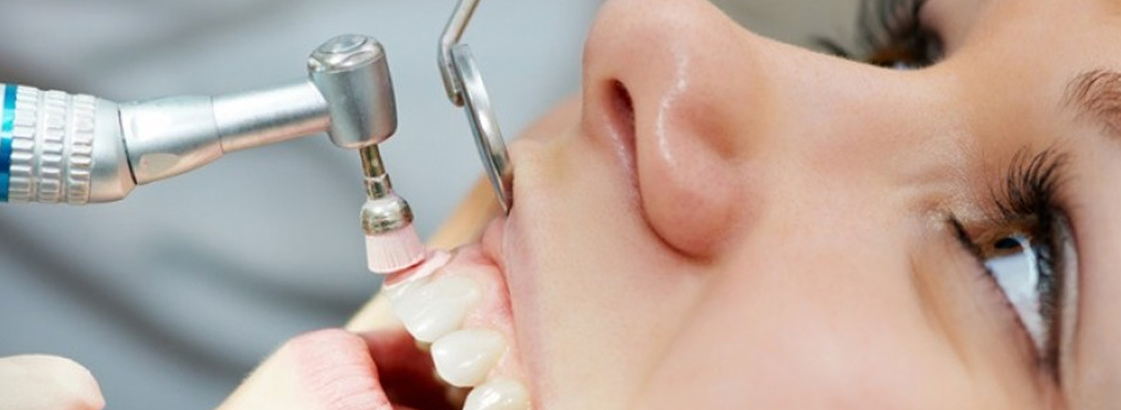 nha-khoa-anh-thu-lay-cao-rang-6