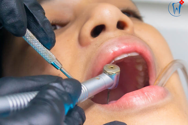 nha-khoa-anh-thu-mien-tru-trach-nhiem-4