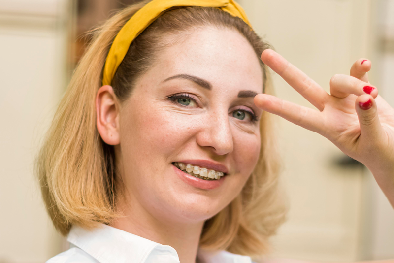 nha-khoa-anh-thu-nieng-rang-mac-cai-7