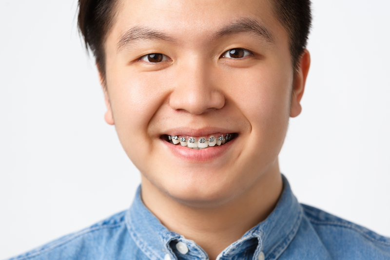 nha khoa anh thư niềng răng trẻ em 1