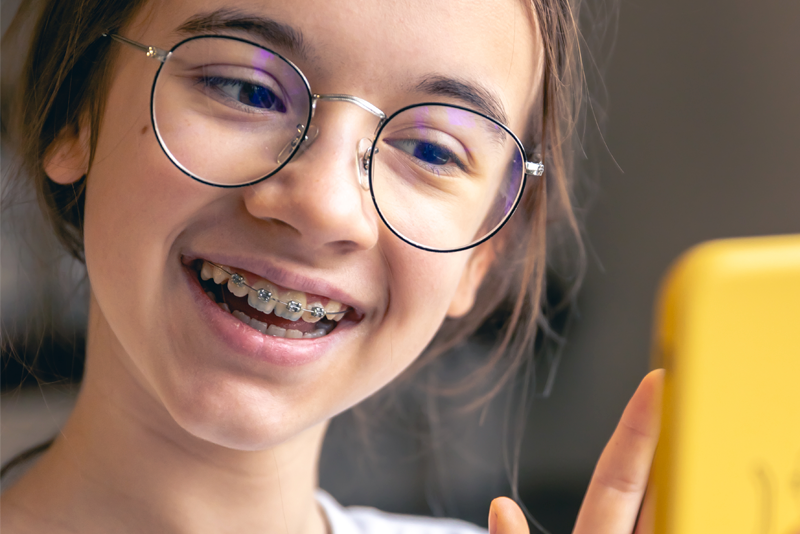 nha khoa anh thư niềng răng trẻ em 3