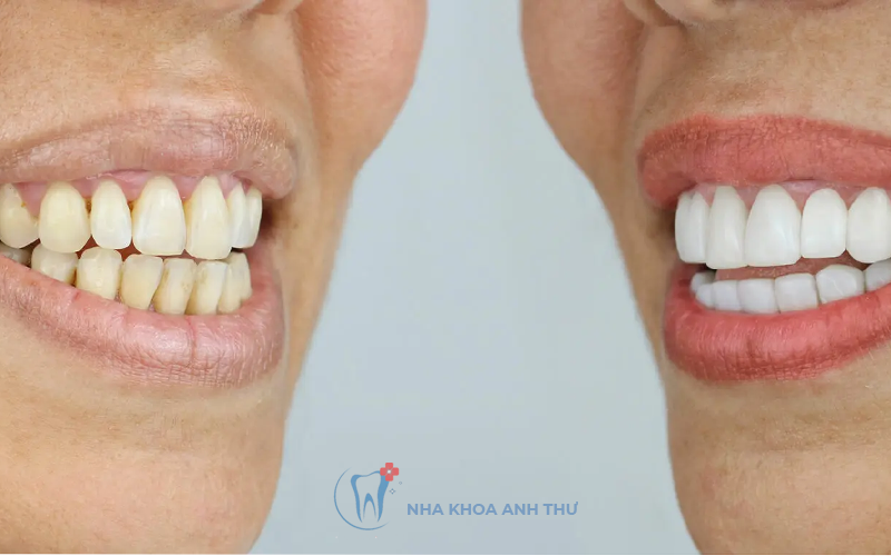 nha-khoa-anh-thu-rang-cua-tham-my-2