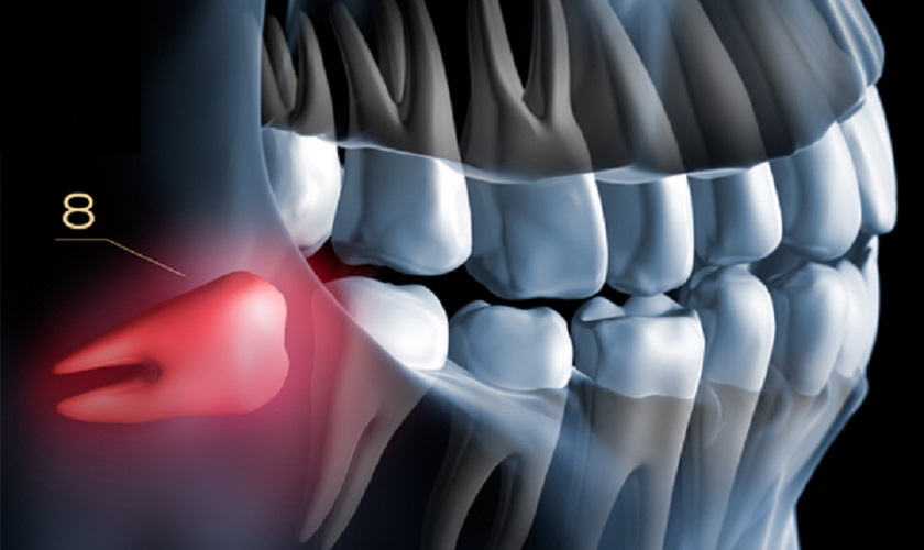 vị trí trong hàm của răng số 8