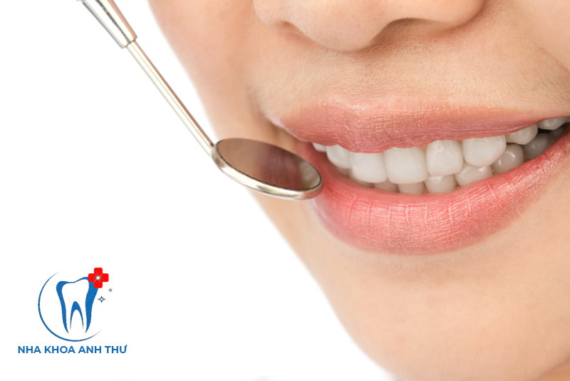 nha-khoa-anh-thu-rang-su-DDBIO-1