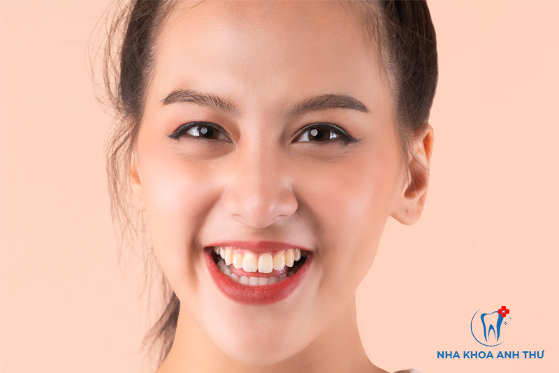 nha-khoa-anh-thu-rang-su-Lava-5