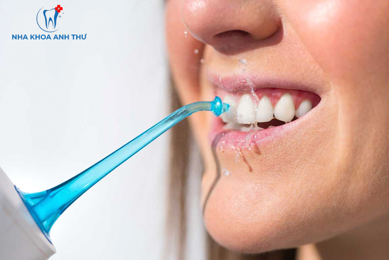 nha-khoa-anh-thu-rang-su-kim-loai-titan-7