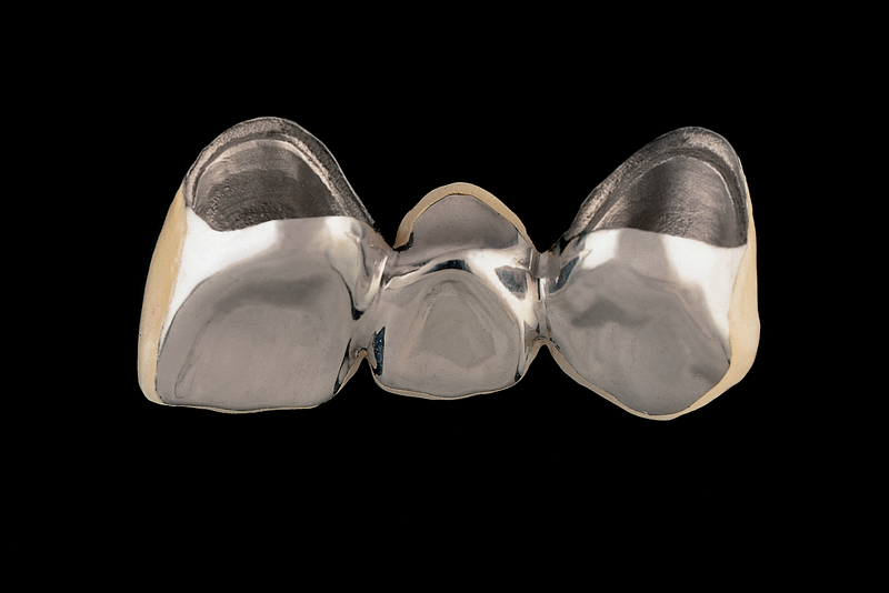 Răng sứ Kim Loại Titan