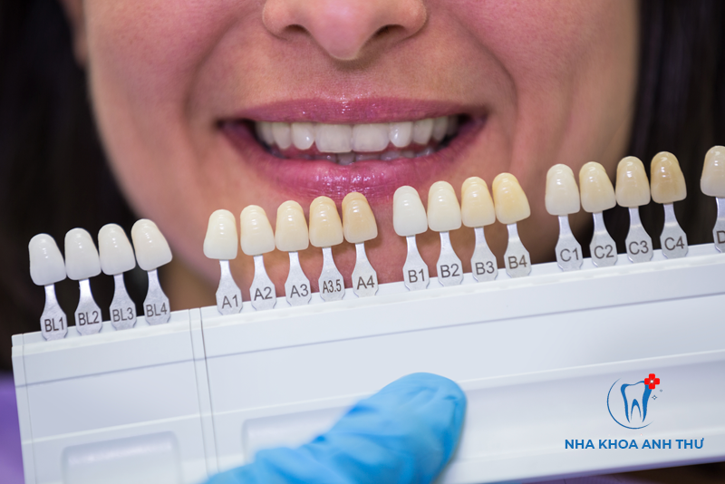 nha-khoa-anh-thu-rang-su-orodent-1