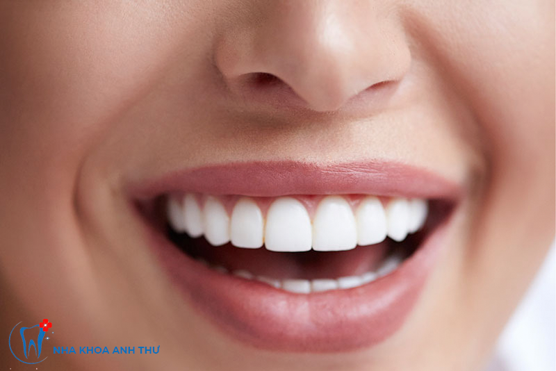 nha-khoa-anh-thu-rang-su-tham-my