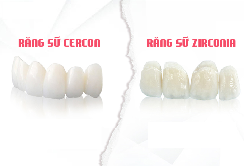 nha-khoa-anh-thu-rang-su-zirconia-4