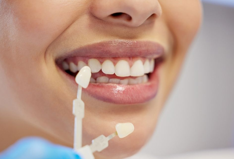 nha-khoa-anh-thu-rang-su-zirconia-7