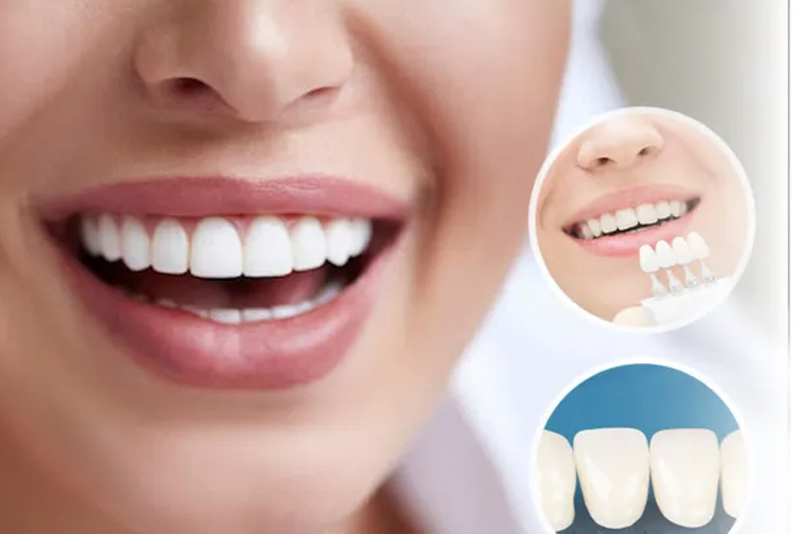 nha-khoa-anh-thu-rang-sư-emax-4