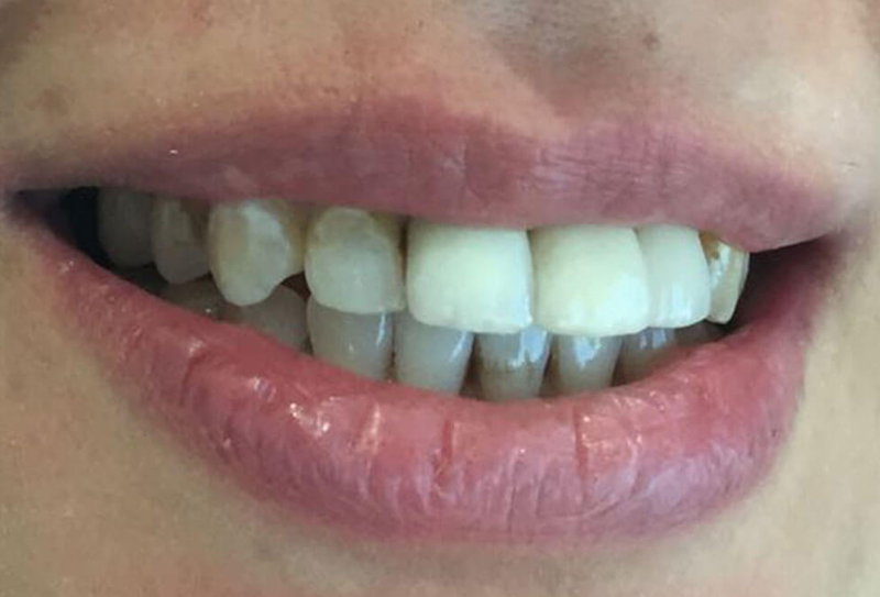 nha-khoa-anh-thu-rang-sư-katana-4