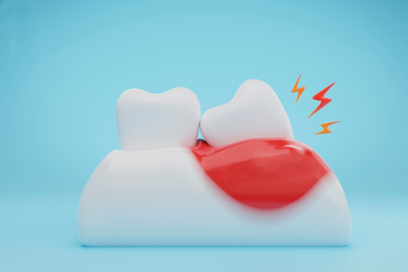 nha khoa anh thư sưng nướu răng -3