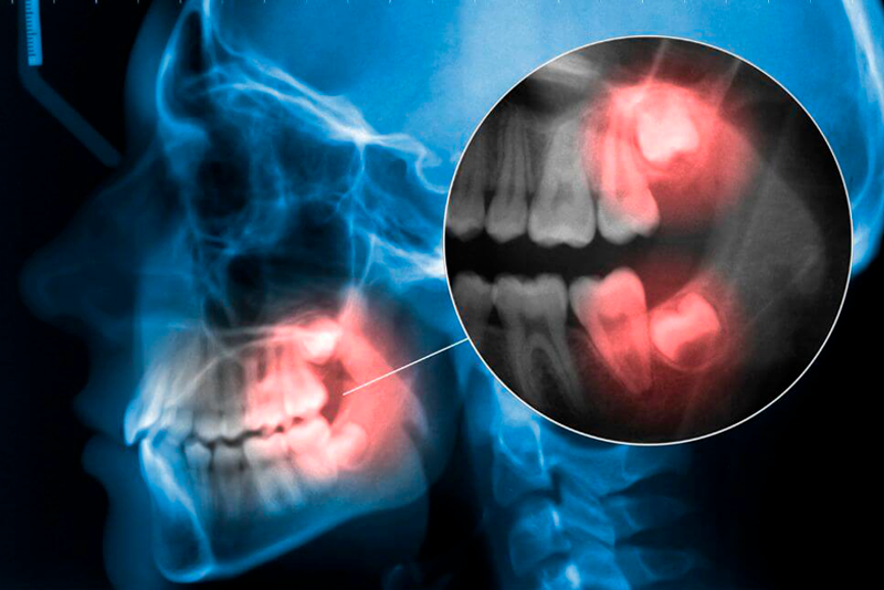 nha khoa anh thư sung nuou rang 6