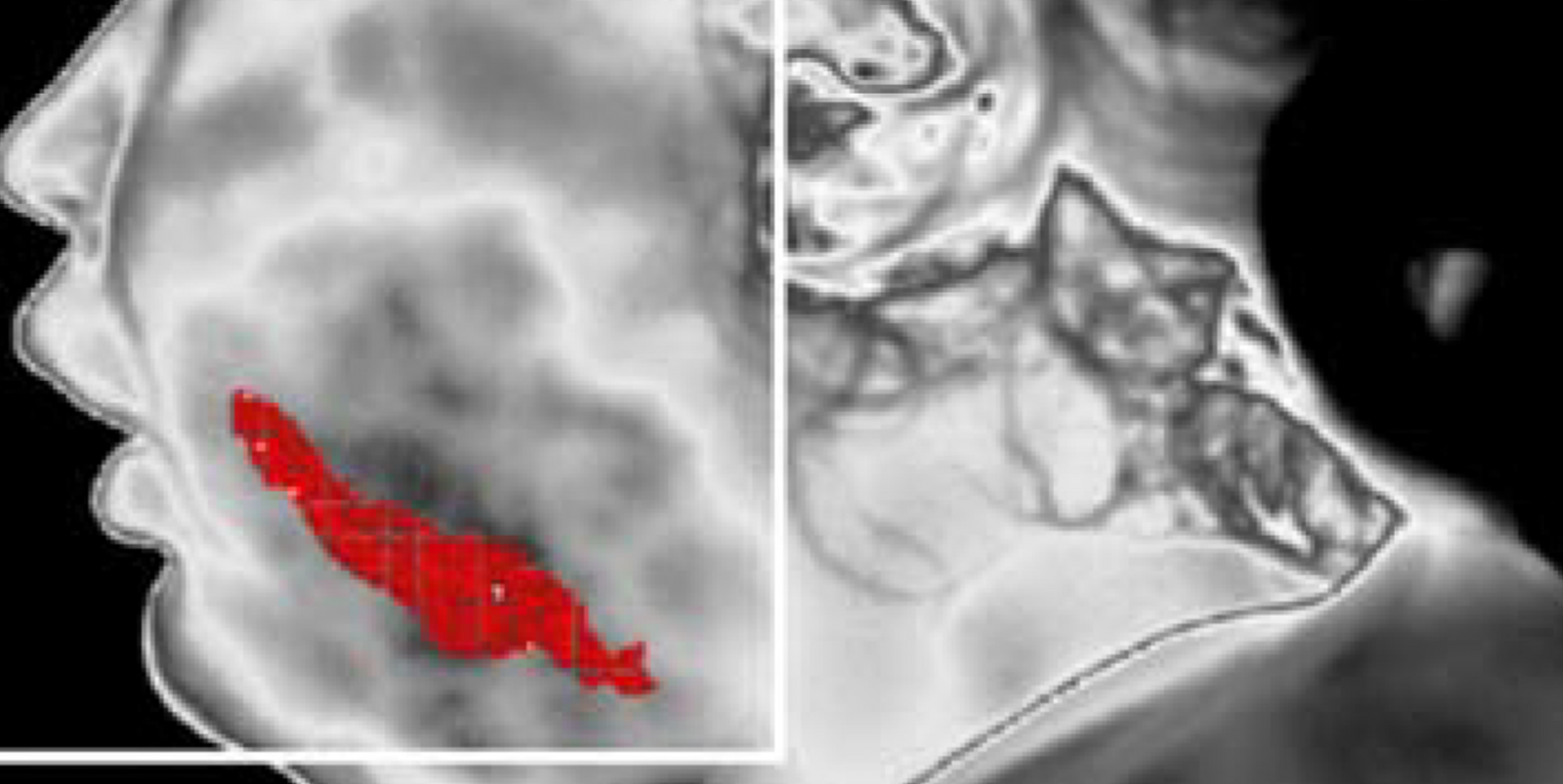 nha khoa anh thu sưng nươu rang -7