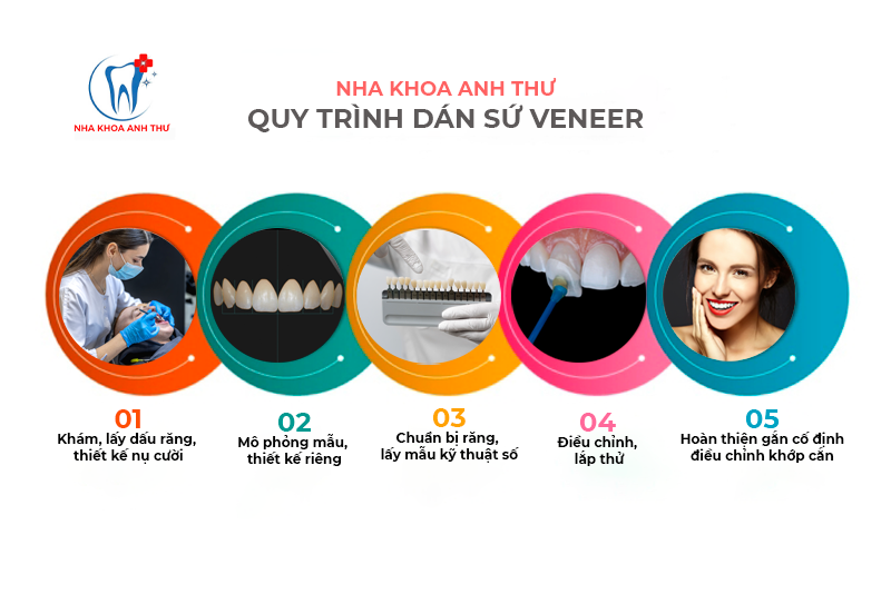 nha khoa anh thư quy trình dán sứ veneer 10